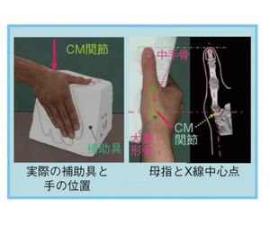 レントゲン撮影用補助具2