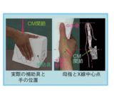 レントゲン撮影用補助具